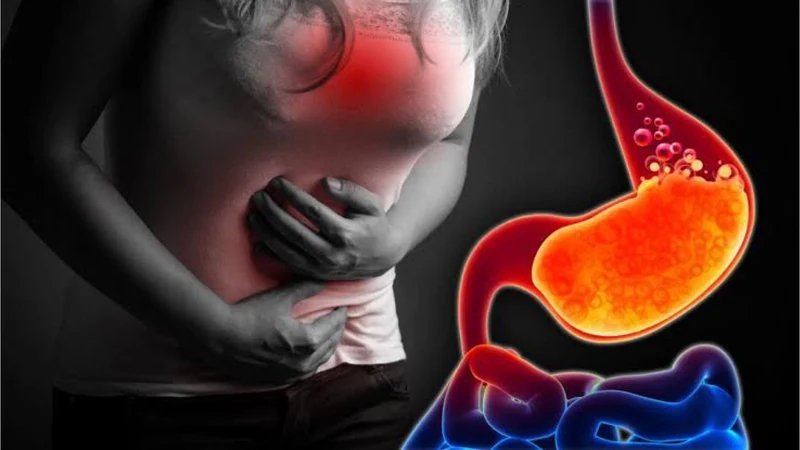 مرض حرقة المعدة (Heartburn)
